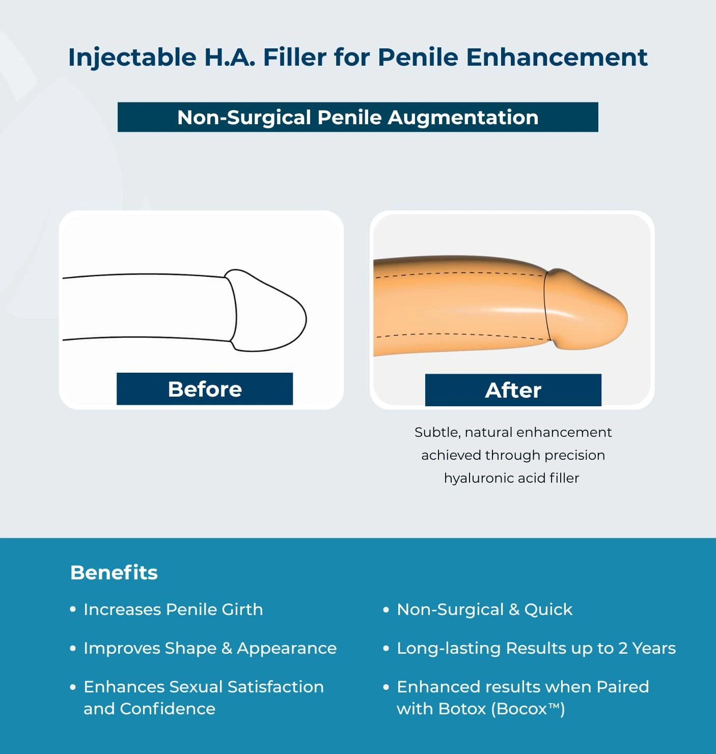 Penis Girth Enhancement Dubai